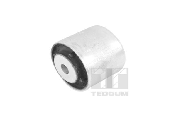 TEDGUM TED41771 Supporto, Differenziale-Supporto, Differenziale-Ricambi Euro